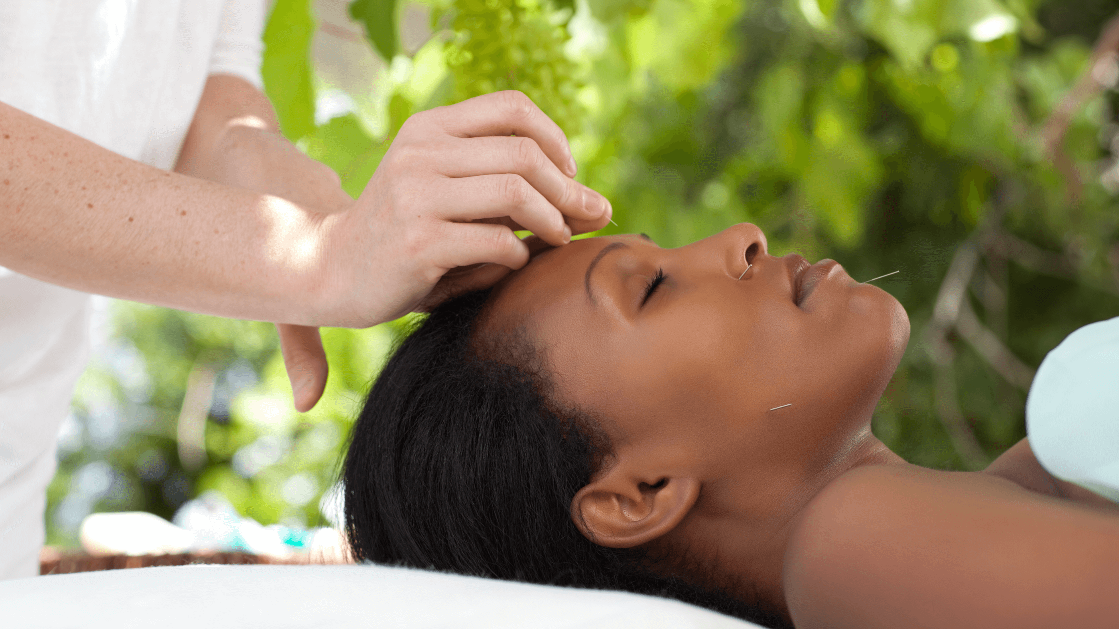 acupuncture treatment