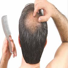 GFC Hair Treatment in Dubai 2