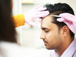 GFC Hair Treatment in Dubai 5