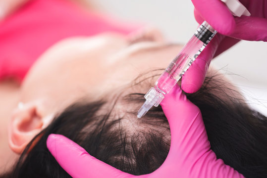 PRP Hair Treatment in Islamabad