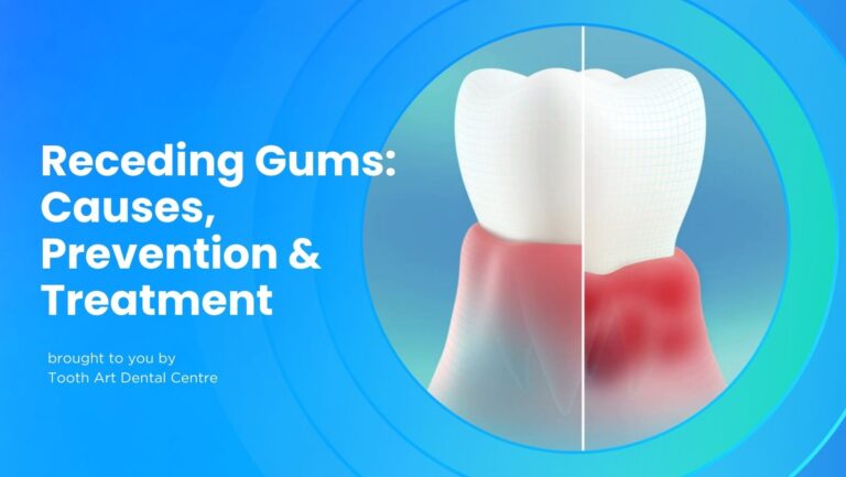 Week-12-Receding-Gums-768x433