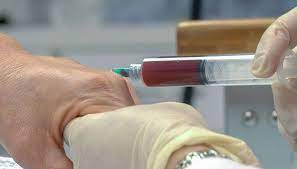 PRP Injections: How London is Leading the Way in Pain Management