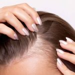 Best exosomes hair therapy in islamabad