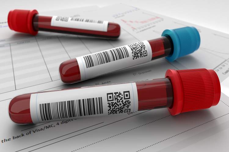 Blood-test-img_1627033133