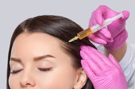 Exosomes hair therapy in Dubai 2