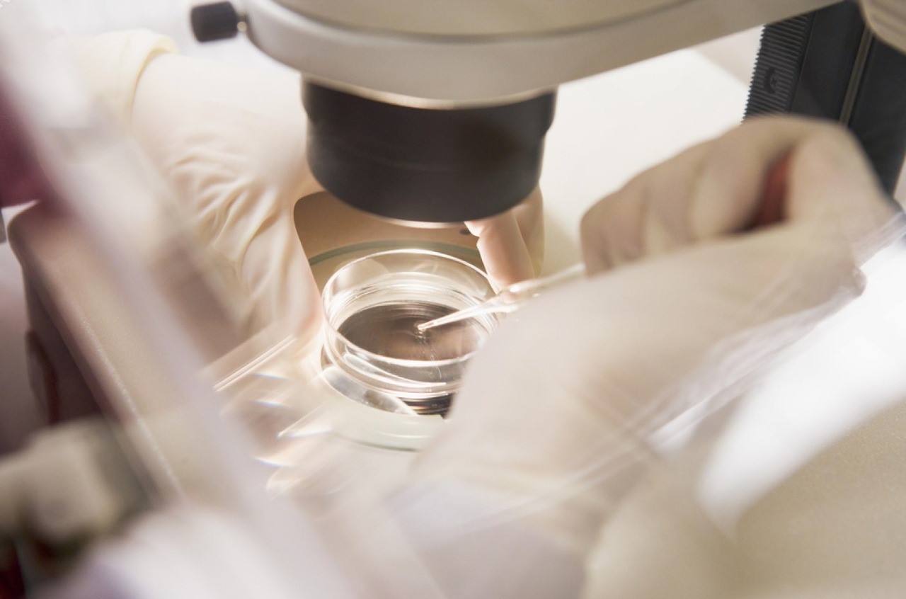 PGD gender selection