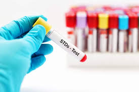 STD Test 3