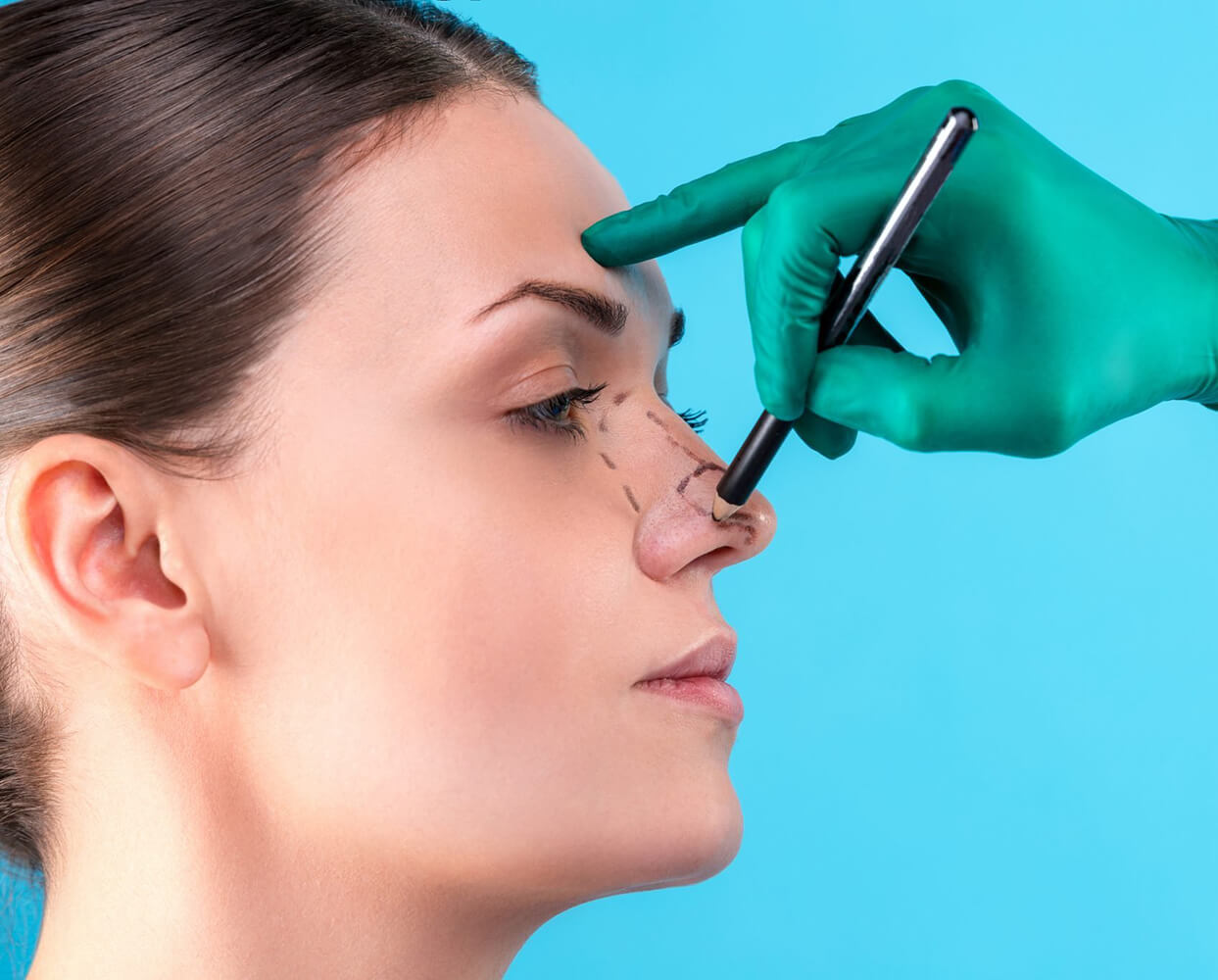 a rhinoplasty
