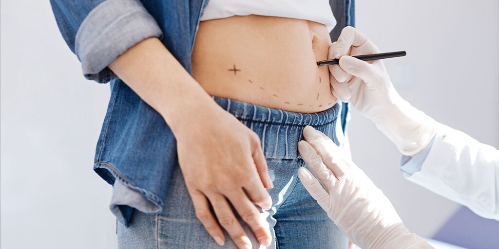 Best abdominoplasty in Islamabad