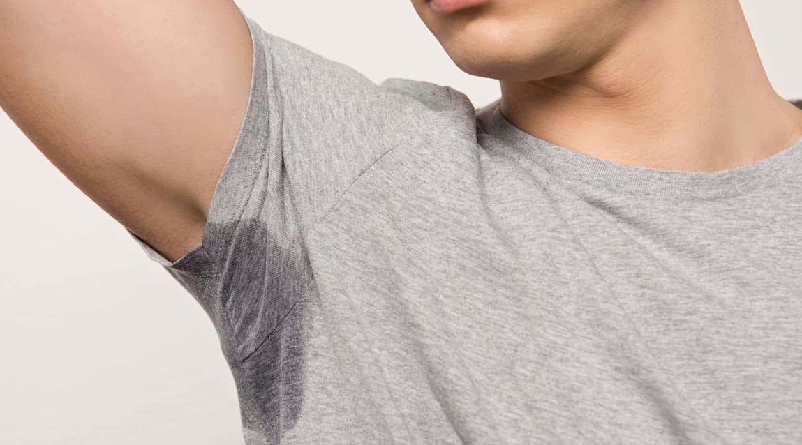 Hyperhidrosis Treatment in Dubai