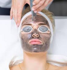 Clear acne scars with Spectra Laser Carbon Peeling.