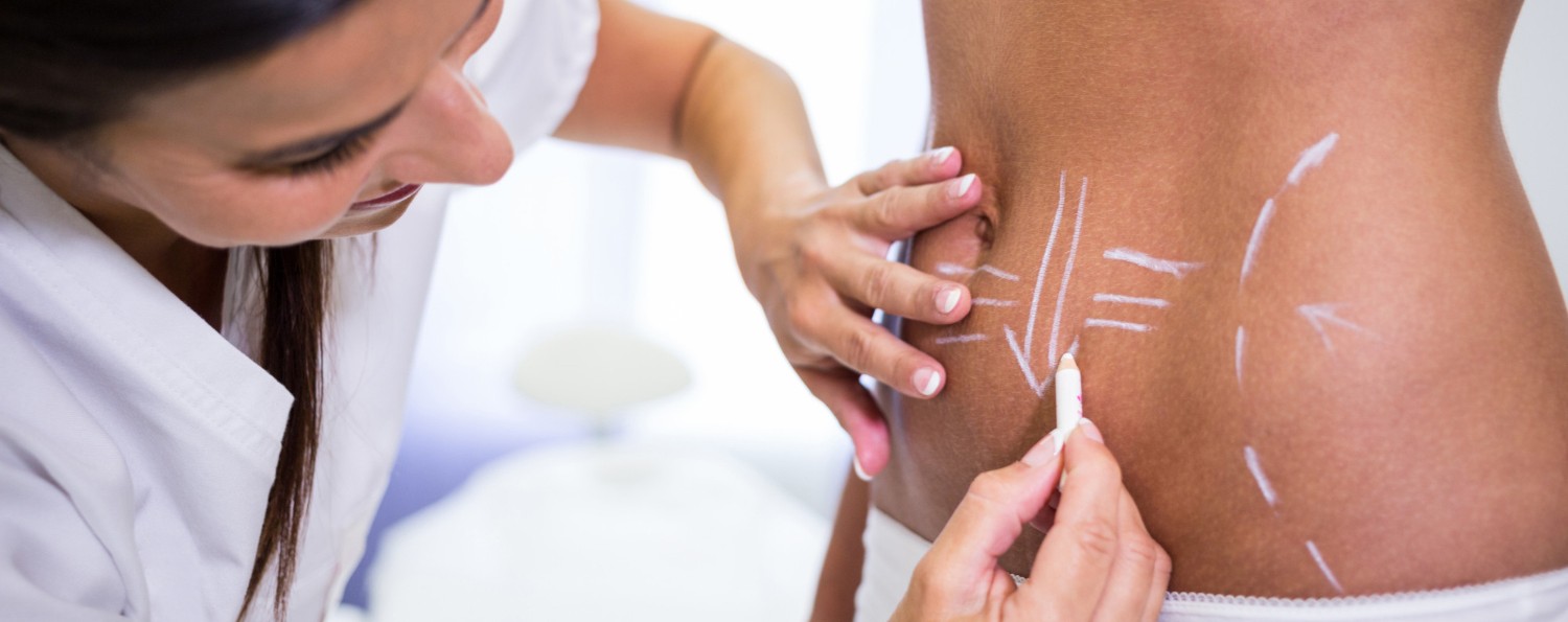 Does Liposuction in Dubai Require an Overnight Hospital Stay