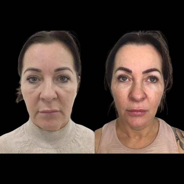 Best Aesthetic Clinic in dubai