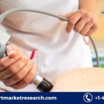 Shock Wave Therapy Device Market (9)
