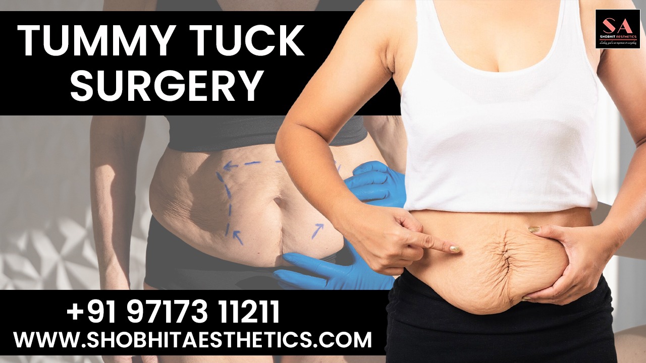 Tummy Tuck Surgery in Delhi (2)