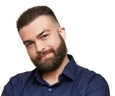 beard hair transplant in Islamabad (3)