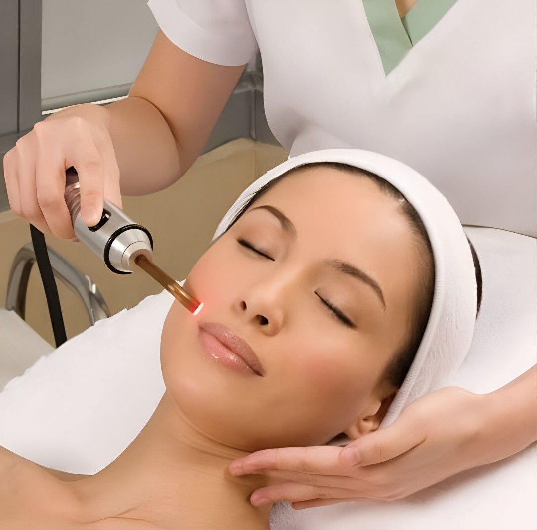 u6292-chemicalpeeltreatmentinIslamabad