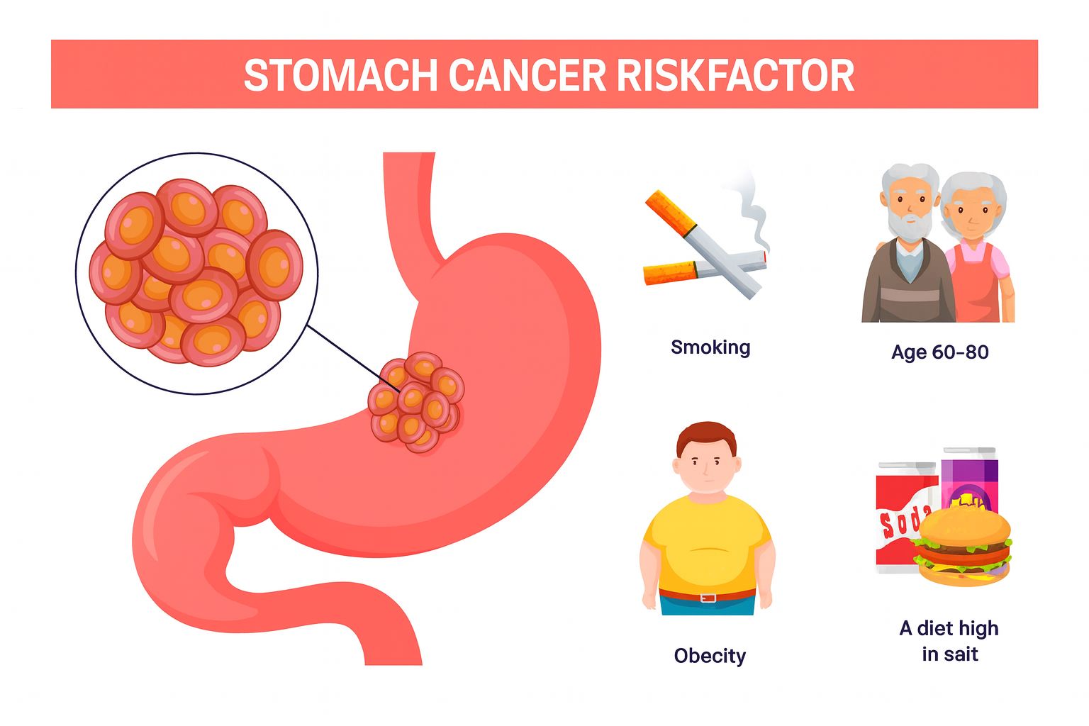 u8573-stomach-cancer-singapore