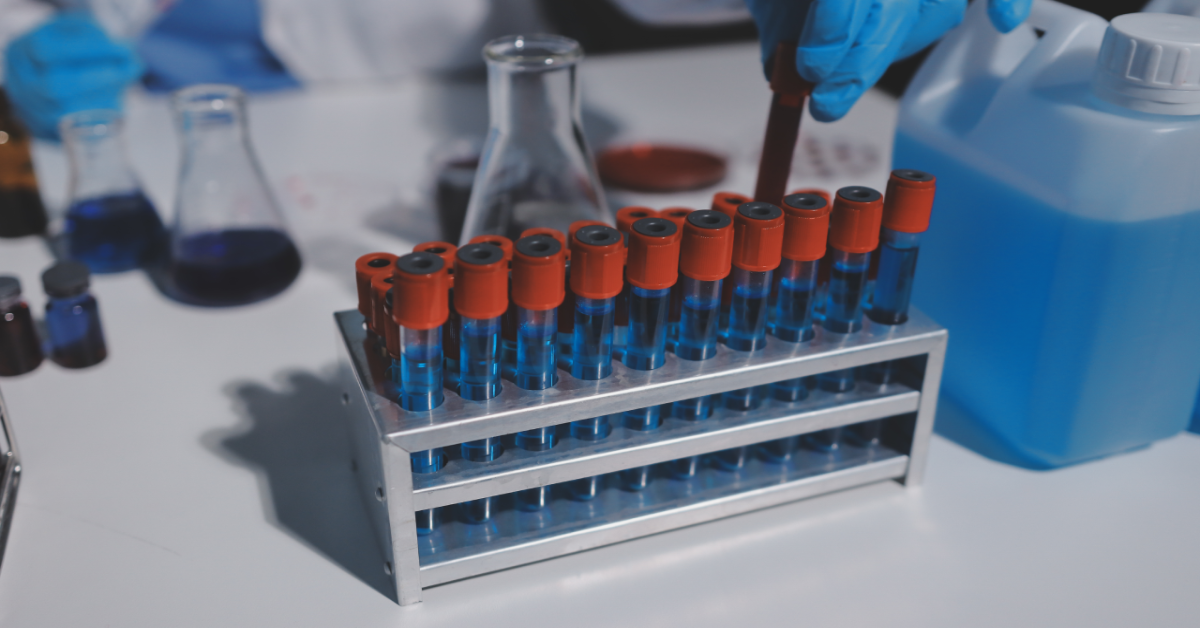 How Biotech Companies Use Reactive Lymph Nodes as Baseline Immune Models