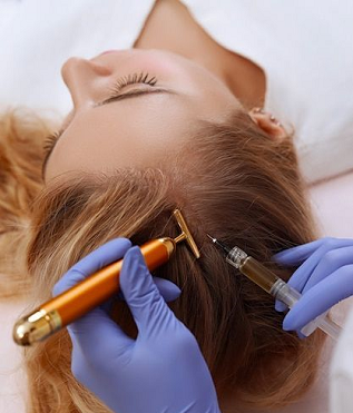 Plasma injection for hairs