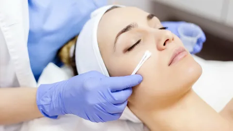 CHEMICAL PEELS